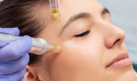 what is mesotherapy